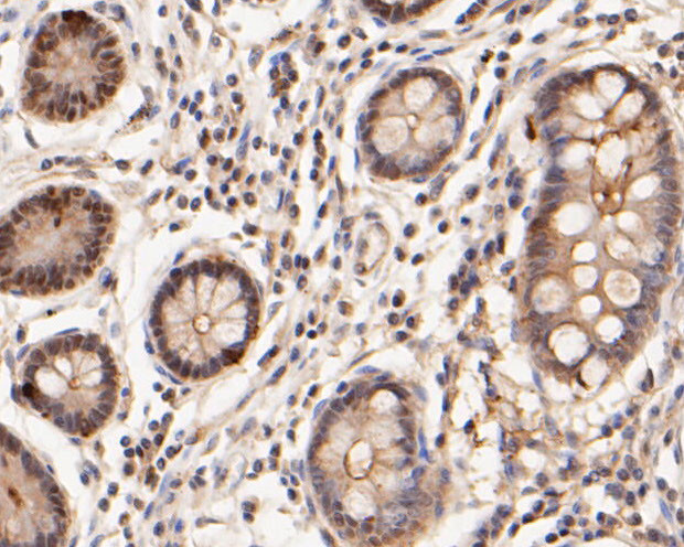 ICAD Antibody in Immunohistochemistry (Paraffin) (IHC (P))