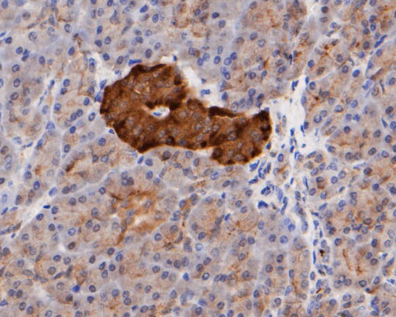 ICAD Antibody in Immunohistochemistry (Paraffin) (IHC (P))