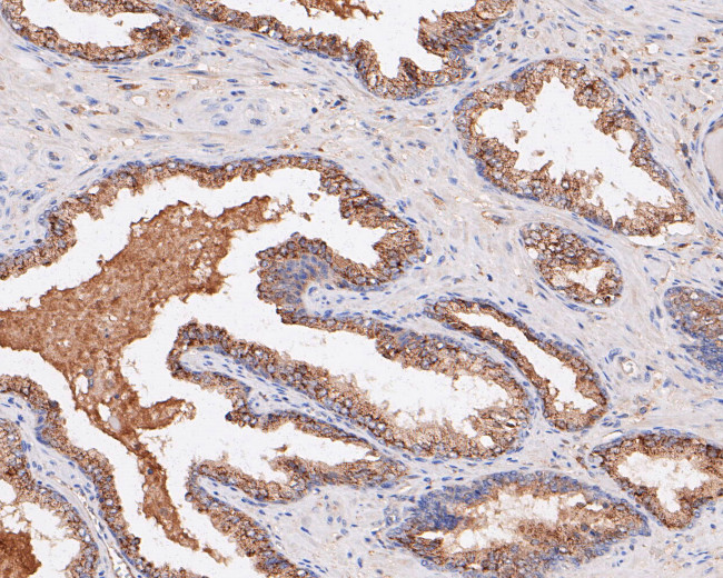 Placental Alkaline Phosphatase Antibody in Immunohistochemistry (Paraffin) (IHC (P))