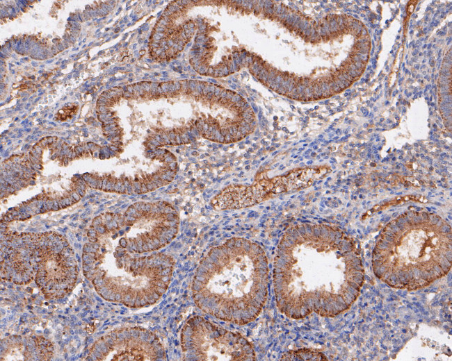 Placental Alkaline Phosphatase Antibody in Immunohistochemistry (Paraffin) (IHC (P))