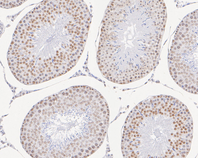 GTF2F2 Antibody in Immunohistochemistry (Paraffin) (IHC (P))