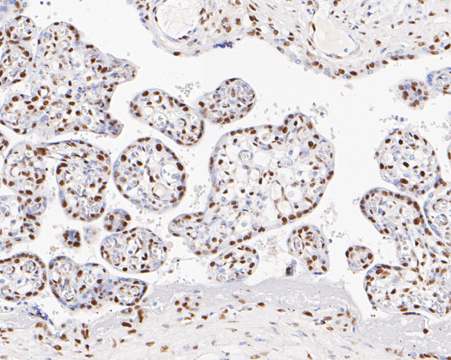 GTF2F2 Antibody in Immunohistochemistry (Paraffin) (IHC (P))