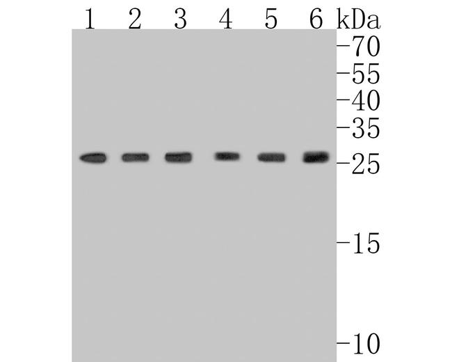 GTF2F2 Antibody in Western Blot (WB)