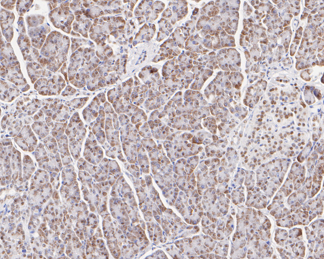 GTF2I Antibody in Immunohistochemistry (Paraffin) (IHC (P))