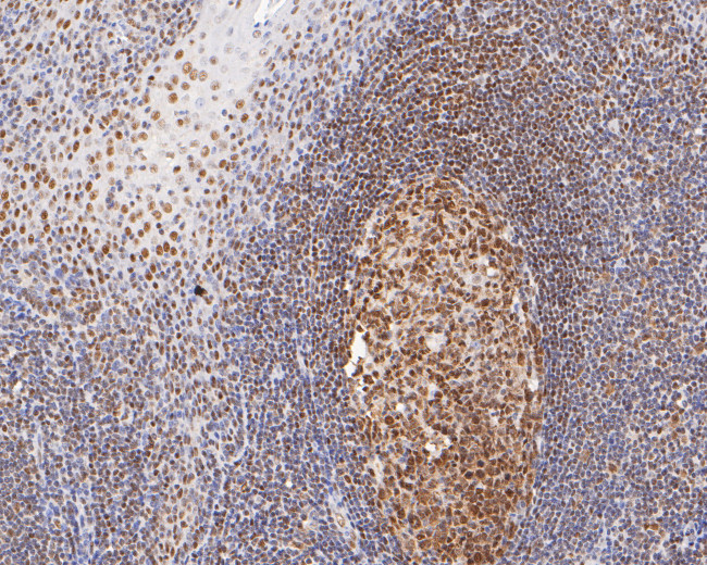 GTF2I Antibody in Immunohistochemistry (Paraffin) (IHC (P))