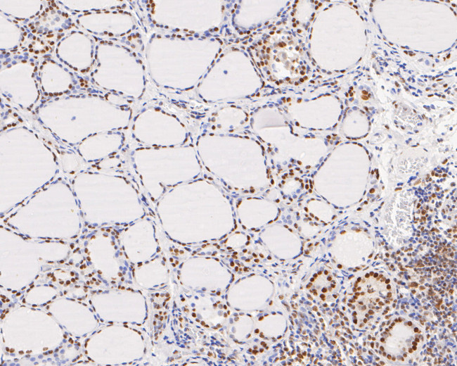 GTF2I Antibody in Immunohistochemistry (Paraffin) (IHC (P))