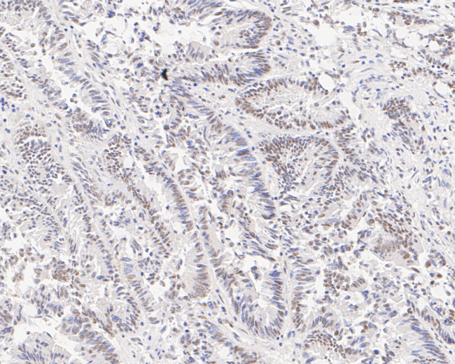 GTF2I Antibody in Immunohistochemistry (Paraffin) (IHC (P))