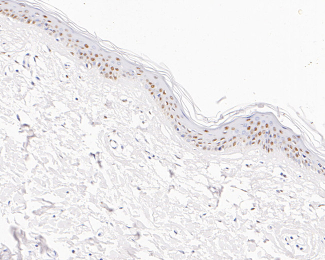 GTF2I Antibody in Immunohistochemistry (Paraffin) (IHC (P))