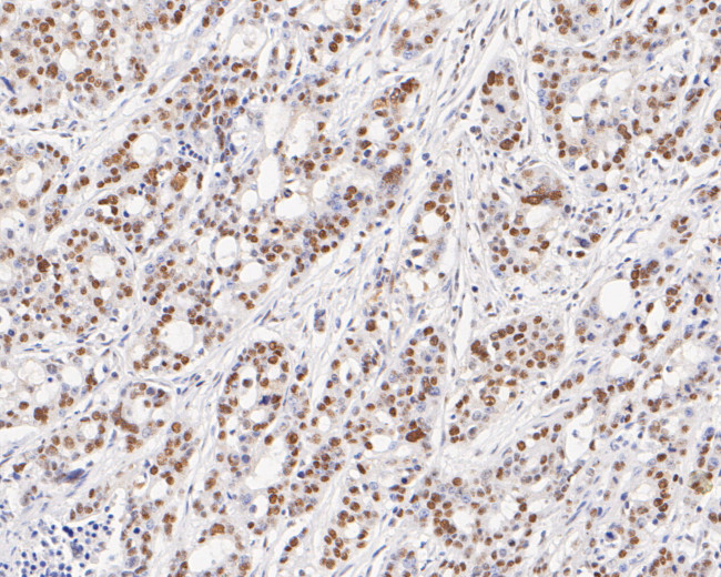 GTF2I Antibody in Immunohistochemistry (Paraffin) (IHC (P))