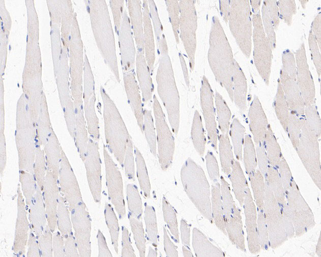 UBE4B Antibody in Immunohistochemistry (Paraffin) (IHC (P))