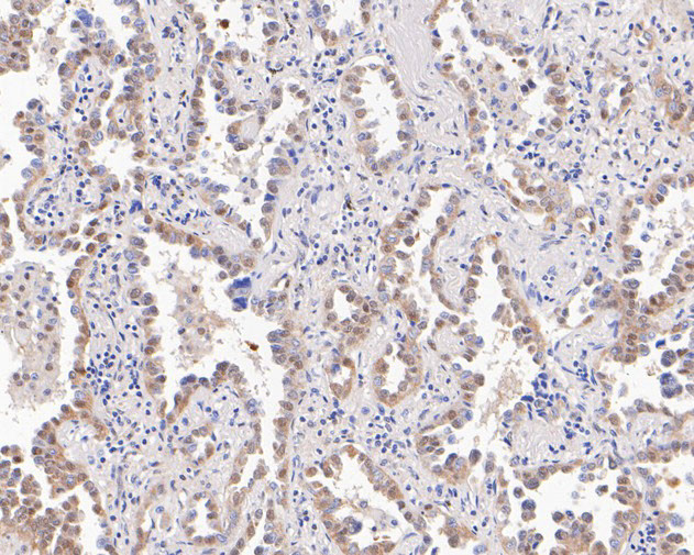 UBE4B Antibody in Immunohistochemistry (Paraffin) (IHC (P))