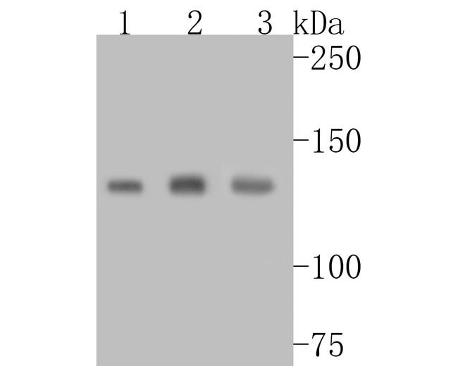 UBE4B Antibody in Western Blot (WB)