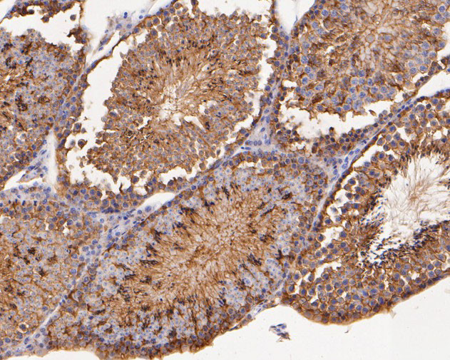 PGD Antibody in Immunohistochemistry (Paraffin) (IHC (P))