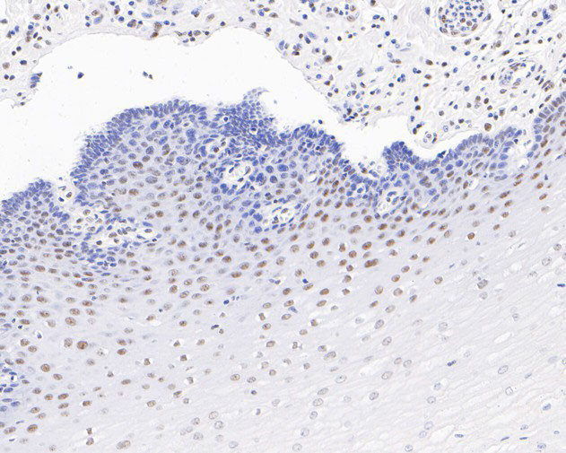 EXOSC7 Antibody in Immunohistochemistry (Paraffin) (IHC (P))