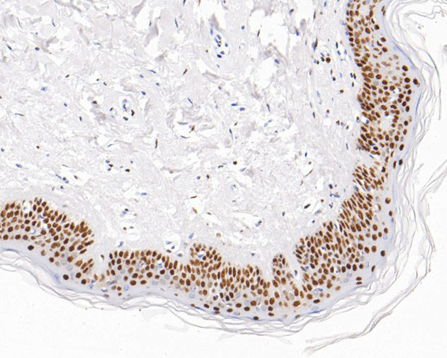 EXOSC7 Antibody in Immunohistochemistry (Paraffin) (IHC (P))