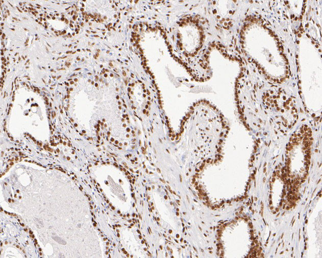 EXOSC7 Antibody in Immunohistochemistry (Paraffin) (IHC (P))