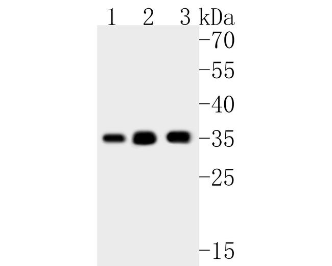 EXOSC7 Antibody in Western Blot (WB)