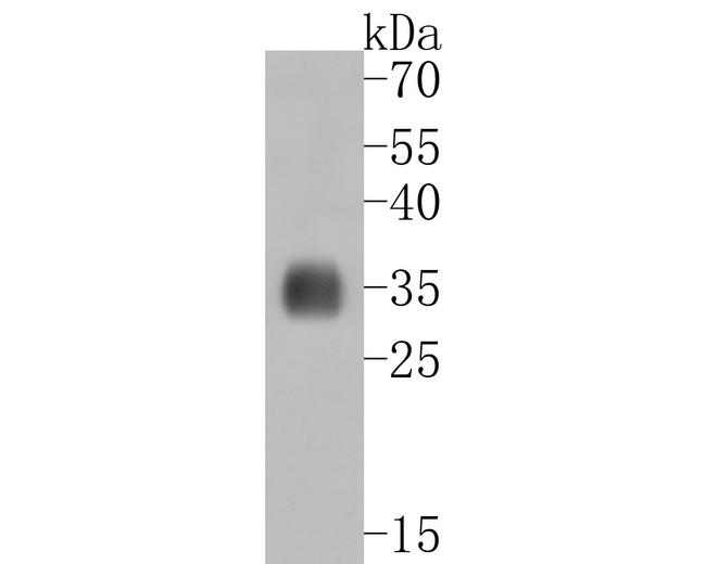 EXOSC7 Antibody in Western Blot (WB)