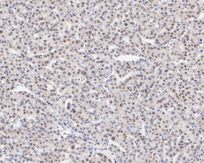 TRMT2A Antibody in Immunohistochemistry (Paraffin) (IHC (P))