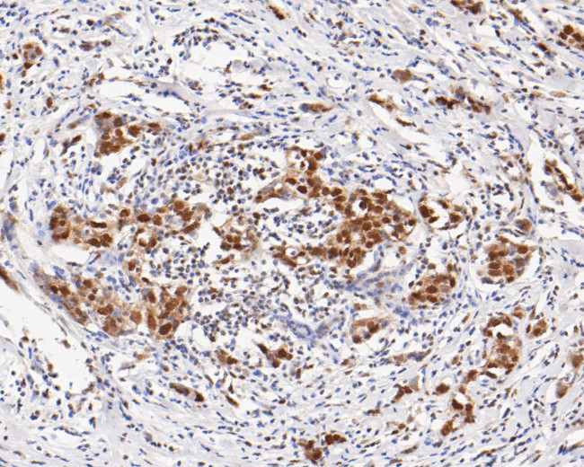 TRMT2A Antibody in Immunohistochemistry (Paraffin) (IHC (P))