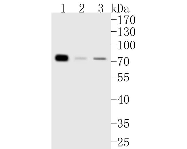 TRMT2A Antibody in Western Blot (WB)