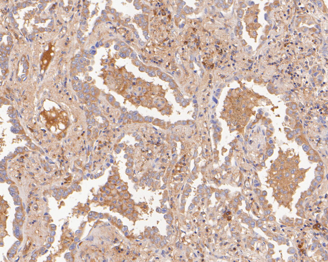 CARS Antibody in Immunohistochemistry (Paraffin) (IHC (P))