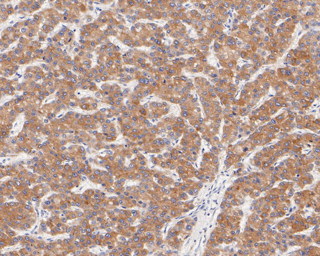 FADS1 Antibody in Immunohistochemistry (Paraffin) (IHC (P))