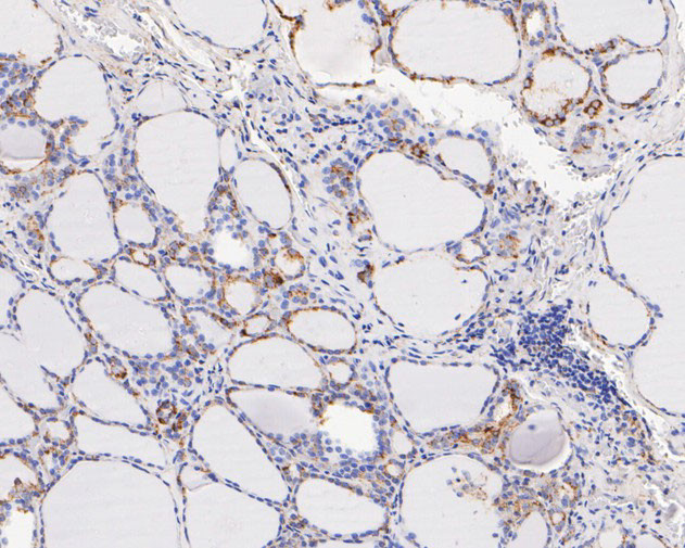 FADS1 Antibody in Immunohistochemistry (Paraffin) (IHC (P))