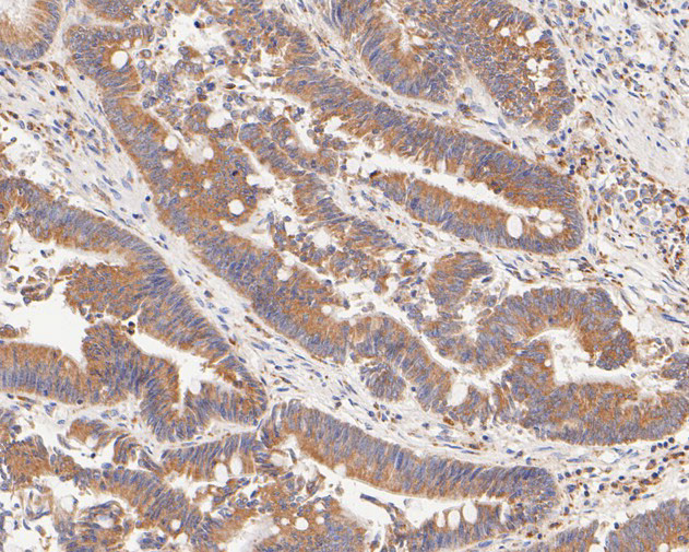 FADS1 Antibody in Immunohistochemistry (Paraffin) (IHC (P))