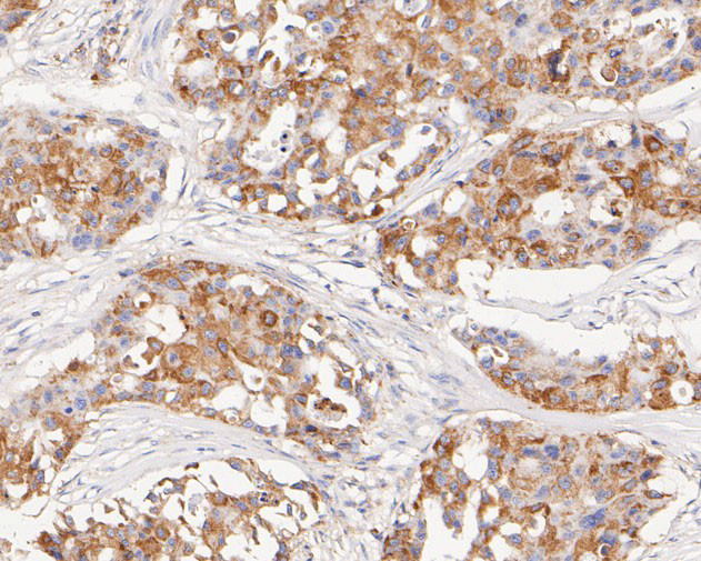 FADS1 Antibody in Immunohistochemistry (Paraffin) (IHC (P))