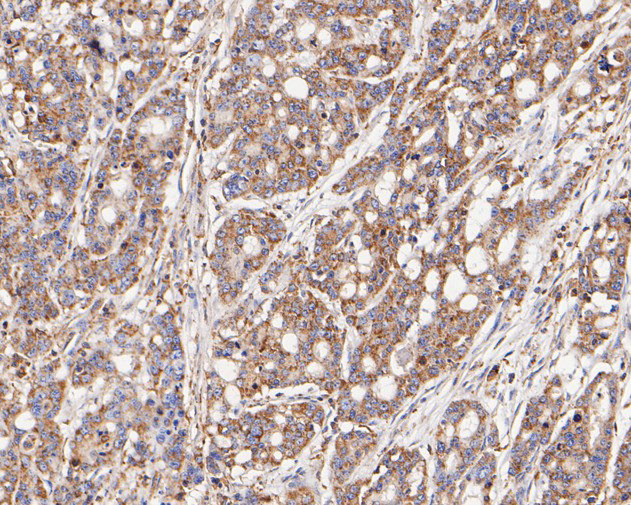 FADS1 Antibody in Immunohistochemistry (Paraffin) (IHC (P))