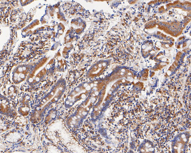 FADS1 Antibody in Immunohistochemistry (Paraffin) (IHC (P))