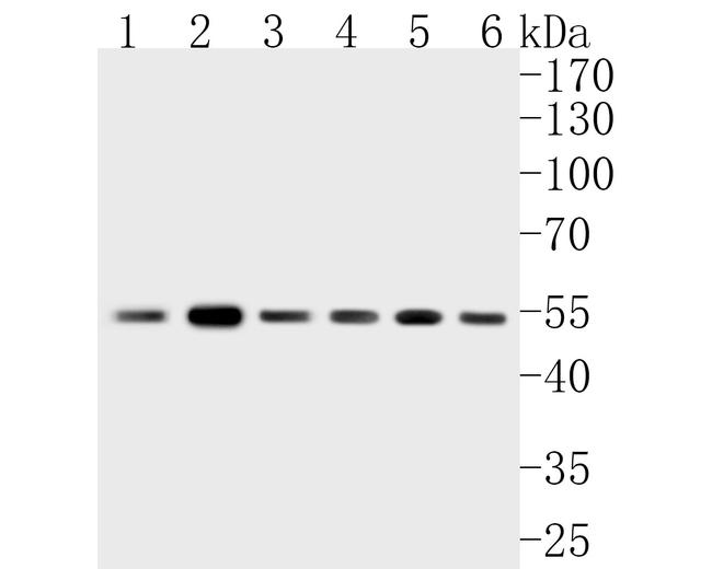 FADS1 Antibody in Western Blot (WB)