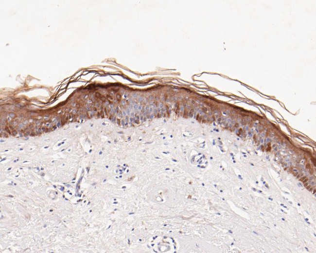 SERPINB3 Antibody in Immunohistochemistry (Paraffin) (IHC (P))