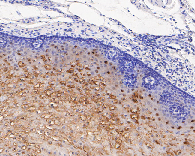 SERPINB3 Antibody in Immunohistochemistry (Paraffin) (IHC (P))