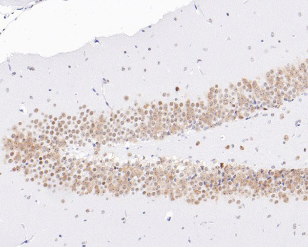 NAT10 Antibody in Immunohistochemistry (Paraffin) (IHC (P))