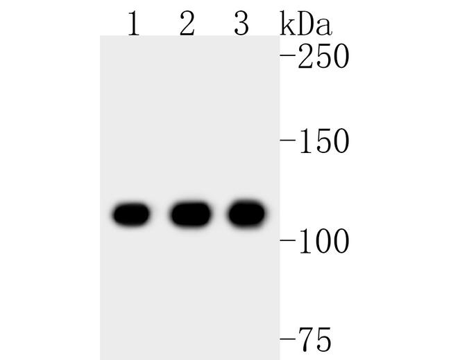 NAT10 Antibody in Western Blot (WB)