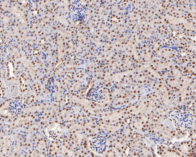 GATAD2A Antibody in Immunohistochemistry (Paraffin) (IHC (P))