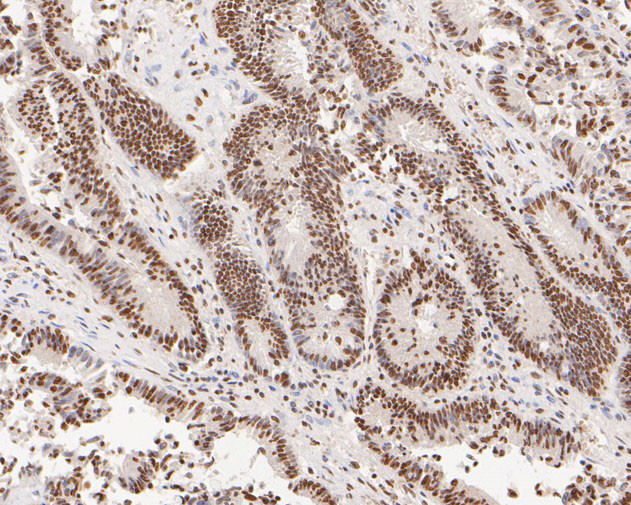 GATAD2A Antibody in Immunohistochemistry (Paraffin) (IHC (P))