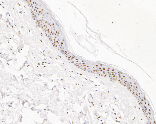 GATAD2A Antibody in Immunohistochemistry (Paraffin) (IHC (P))