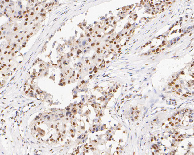 GATAD2A Antibody in Immunohistochemistry (Paraffin) (IHC (P))