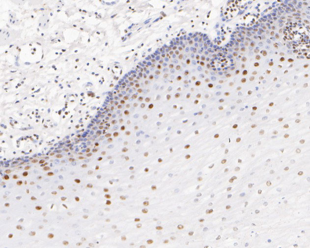 GATAD2A Antibody in Immunohistochemistry (Paraffin) (IHC (P))