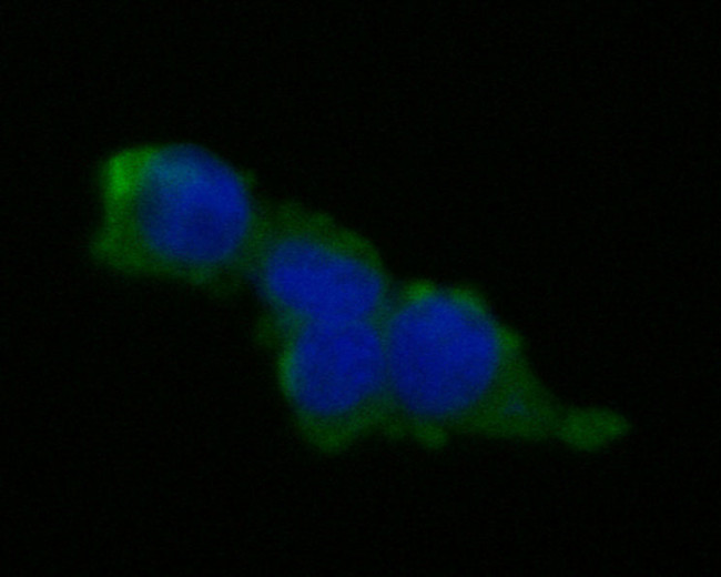 Desmocollin 3 Antibody in Immunocytochemistry (ICC/IF)