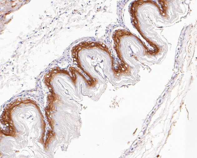 Desmocollin 3 Antibody in Immunohistochemistry (Paraffin) (IHC (P))