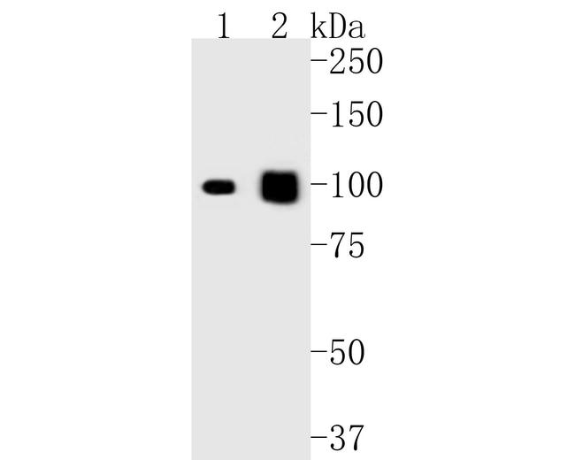 Desmocollin 3 Antibody in Western Blot (WB)