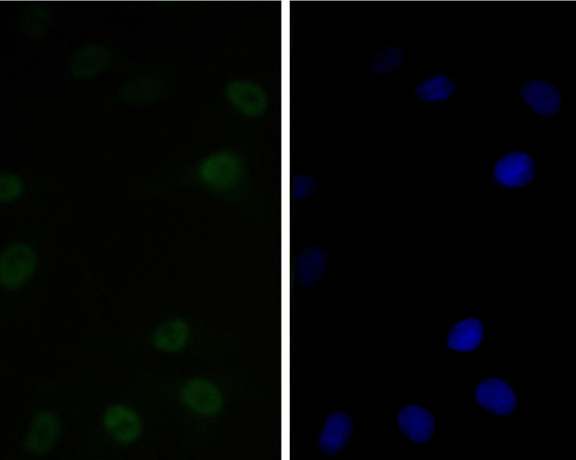 CtBP2 Antibody in Immunocytochemistry (ICC/IF)