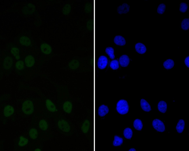 CtBP2 Antibody in Immunocytochemistry (ICC/IF)