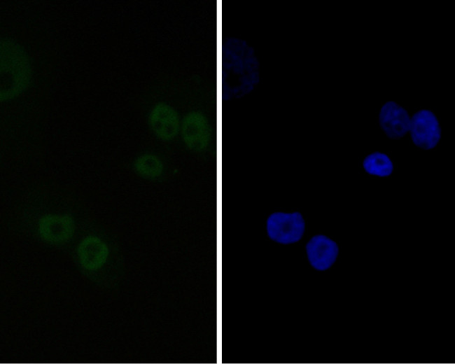 CtBP2 Antibody in Immunocytochemistry (ICC/IF)