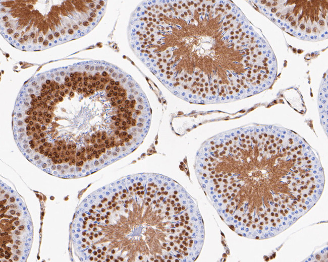 CtBP2 Antibody in Immunohistochemistry (Paraffin) (IHC (P))