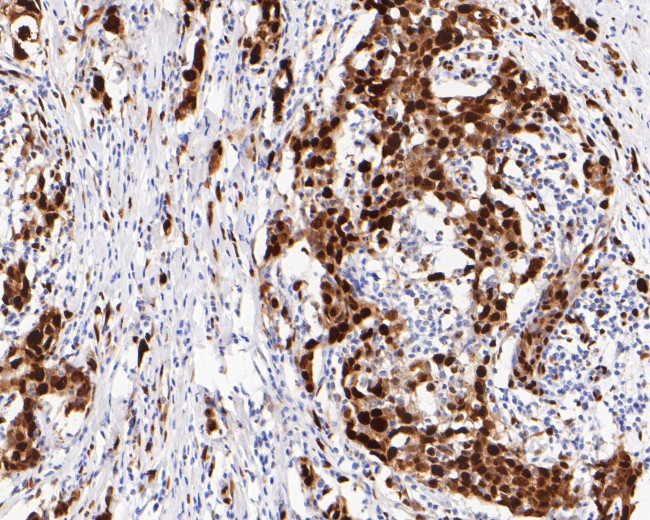 CtBP2 Antibody in Immunohistochemistry (Paraffin) (IHC (P))